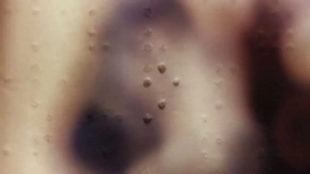 4 de Janeiro – Dia Mundial do Braille